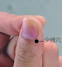 少商放血就相当于将肺经过热的气血引出去,还肺一个清凉的